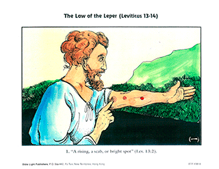 Law of the Leper - 1
